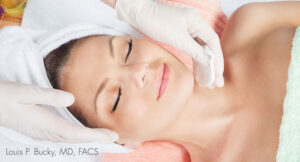 chemical peel image